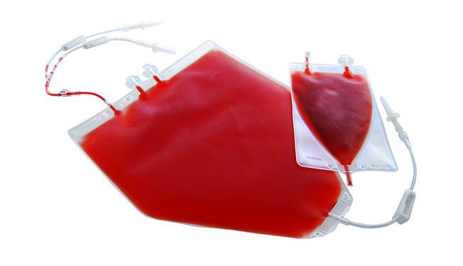 Non-Barrier Bag Market Share Analysis