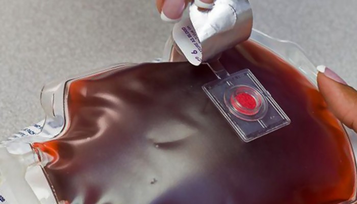 Blood Temperature Indicator Market